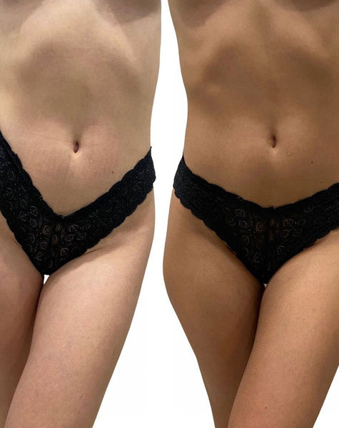 Ultra Dark - Pro Mgiełka Samoopalająca